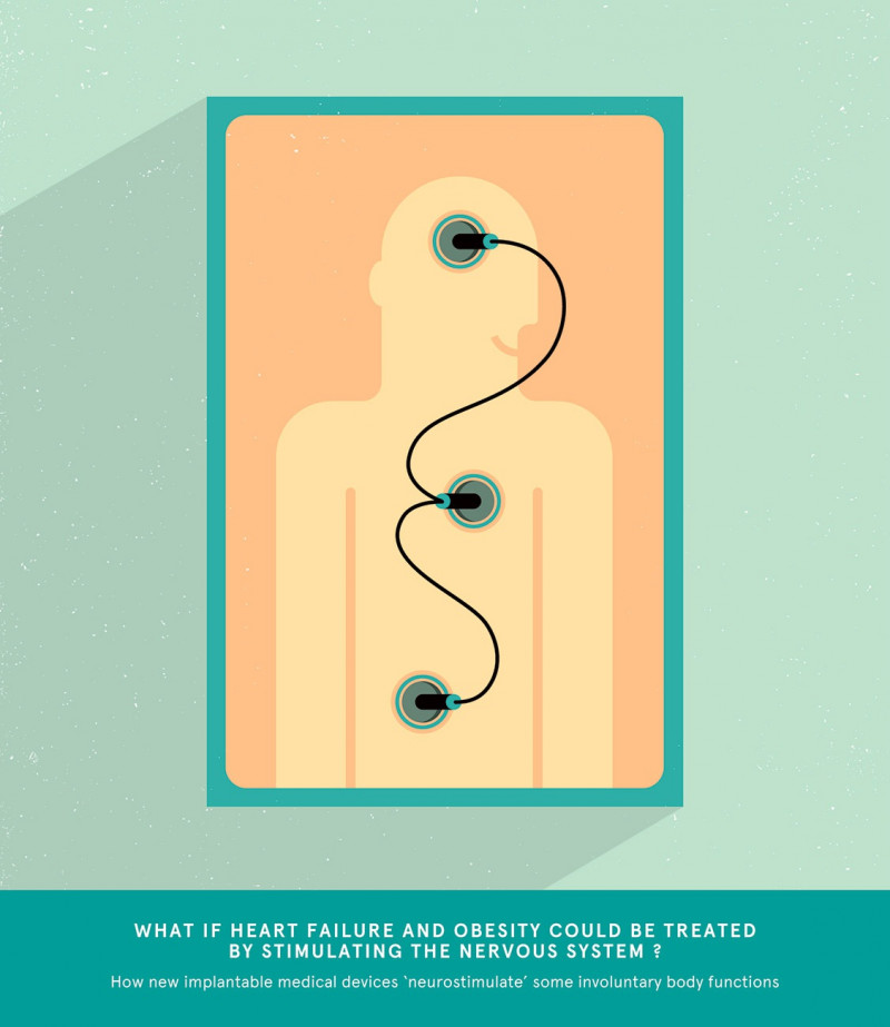 Laurent Duvoux - Talkie Walkie