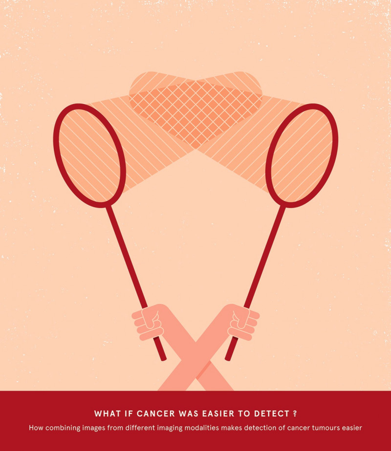 Laurent Duvoux - Talkie Walkie